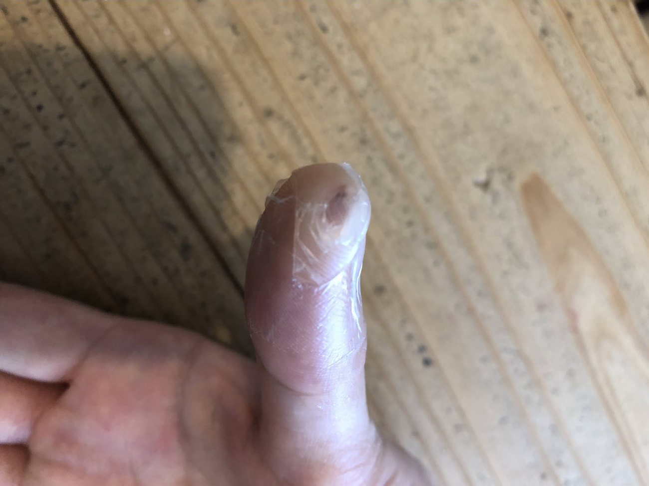 スライサーで切った親指